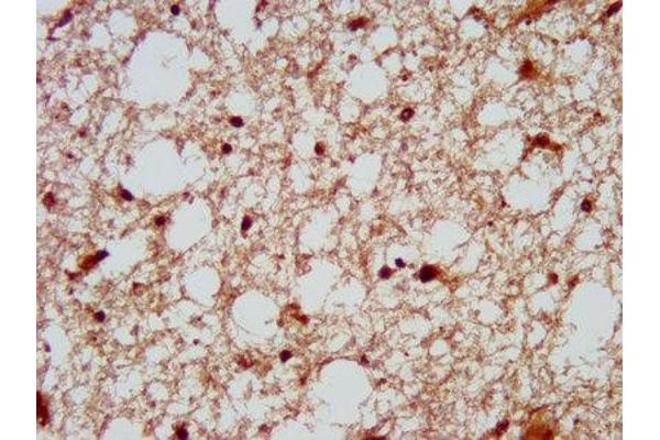 DSCAM antibody  (AA 1711-1867)