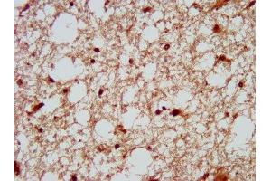 IHC image of ABIN7150649 diluted at 1:200 and staining in paraffin-embedded human brain tissue performed on a Leica BondTM system.
