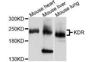 Western blot analysis of extracts of various cells, using KDR antibody. (VEGFR2/CD309 antibody)