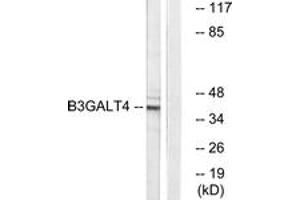 Western blot analysis of extracts from Jurkat cells, using B3GALT4 Antibody. (B3GALT4 antibody  (AA 181-230))