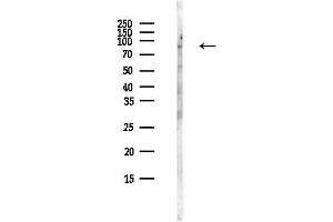 Western blot analysis of lysates from MCF7 cells(heat-shock,45 min treatment), using Phospho-MARCKS (Ser46) Antibody at 1/1000 dilution.