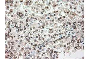 Immunohistochemical staining of paraffin-embedded liver tissue using anti-SERPINA1mouse monoclonal antibody.