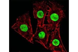 Fluorescent image of C2C12cells stained with Hmga2 antibody at 1:25 dilution. (HMGA2 antibody  (C-Term))