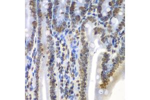 Immunohistochemistry of paraffin-embedded mouse Intestine using SEPT7 antibody (ABIN5971967) at dilution of 1/100 (40x lens).