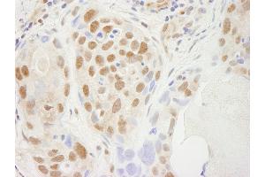 Immunohistochemistry (IHC) image for anti-Transcription Elongation Factor SPT5 (SUPT5H) (C-Term) antibody (ABIN7448819)