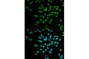 Immunofluorescence analysis of MCF-7 cells using FANCD2 antibody. (FANCD2 antibody  (AA 1-230))