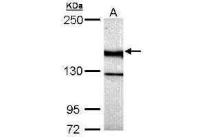 WB Image Sample (30 ug of whole cell lysate) A: Hela 5% SDS PAGE antibody diluted at 1:5000 (UNC13B antibody  (Center))