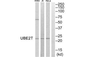 Western blot analysis of extracts from HeLa cells, Jurkat cells and K562 cells, using UBE2T antibody. (Ube2t antibody  (Internal Region))
