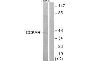 Western blot analysis of extracts from HUVEC cells, using CCKAR antibody. (CCKAR antibody  (Internal Region))