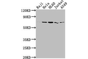 Western Blot Positive WB detected in: Raji whole cell lysate, Hela whole cell lysate, HL60 whole cell lysate, Jurkat whole cell lysate, A549 whole cell lysate All lanes: PRMT5 antibody at 1:2000 Secondary Goat polyclonal to rabbit IgG at 1/50000 dilution Predicted band size: 73, 72, 54, 68, 67 kDa Observed band size: 73 kDa (Recombinant PRMT5 antibody)