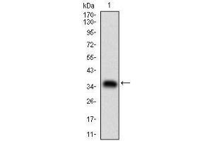 Western blot analysis using ABCB1 mAb against human ABCB1 (AA: 632-693) recombinant protein. (ABCB1 antibody  (AA 632-693))