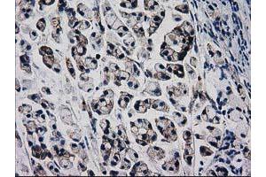 Image no. 3 for anti-Catenin (Cadherin-Associated Protein), beta 1, 88kDa (CTNNB1) antibody (ABIN1496890) (CTNNB1 antibody)