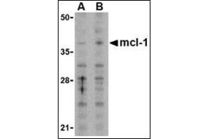 Western blot analysis of Mcl-1in Raji cell lysates with this product at (A) 1 and (B) 2 μg/ml.