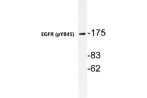 Western blot (WB) analyzes of p-EGFR antibody in extracts from A431 cells. (EGFR antibody  (pTyr869))
