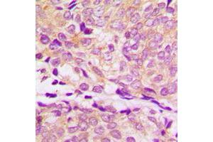 Immunohistochemistry (IHC) image for anti-Heat Shock Protein 90kDa alpha (Cytosolic), Class A Member 2 (HSP90AA2) (C-Term) antibody (ABIN7295932)