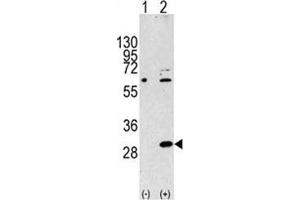 Western blot analysis of EIF4E2 antibody and 293 cell lysate either nontransfected (Lane 1) or transiently transfected with the EIF4E2 gene (2). (EIF4E2 antibody  (AA 12-41))