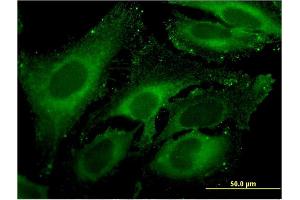 Immunofluorescence of monoclonal antibody to CPA4 on HeLa cell. (CPA4 antibody  (AA 260-361))
