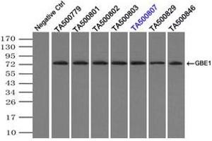 Image no. 1 for anti-Glucan (1,4-alpha-), Branching Enzyme 1 (GBE1) antibody (ABIN1498395) (GBE1 antibody)