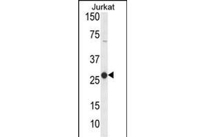 Western blot analysis of C Antibody (Center) (ABIN653826 and ABIN2843094) in Jurkat cell line lysates (35 μg/lane). (CD160 antibody  (AA 56-82))