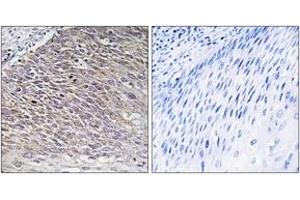 Immunohistochemistry analysis of paraffin-embedded human testis tissue, using MAST4 Antibody. (MAST4 antibody  (AA 251-300))