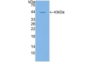 Detection of Recombinant CD19, Human using Polyclonal Antibody to Cluster Of Differentiation 19 (CD19) (CD19 antibody  (AA 160-258))