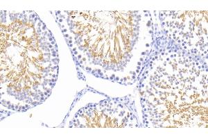 Detection of HSPA1L in Rat Testis Tissue using Polyclonal Antibody to Heat Shock 70 kDa Protein 1 Like Protein (HSPA1L) (HSPA1L antibody  (AA 1-641))