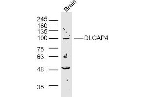 Rat brain lysates probed with SAPAP4/DLGAP4 Polyclonal Antibody, unconjugated  at 1:300 overnight at 4°C followed by a conjugated secondary antibody at 1:10000 for 90 minutes at 37°C. (DLGAP4 antibody  (AA 261-370))