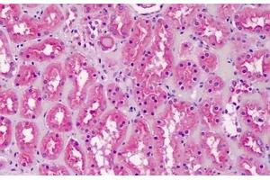 Human Kidney: Formalin-Fixed, Paraffin-Embedded (FFPE) (CRLS1 antibody  (AA 161-174))
