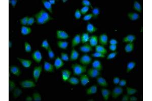 Immunofluorescence staining of Hela cells with ABIN7149579 at 1:66, counter-stained with DAPI. (DOCK1 antibody  (AA 1676-1865))