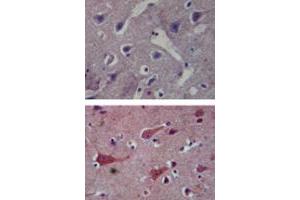 Immunohistochemical analysis of TLR8 in paraffin-embedded formalin-fixed human brain tissue using an isotype control (top) and TLR8 monoclonal antibody, clone 44C143  (bottom) at 5 ug/mL .