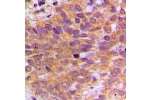 Immunohistochemistry (IHC) image for anti-C-Abl Oncogene 1, Non-Receptor tyrosine Kinase (ABL1) (C-Term) antibody (ABIN7299030)