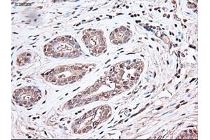 Immunohistochemical staining of paraffin-embedded breast using anti-Trim33 (ABIN2452535) mouse monoclonal antibody.