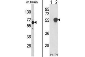 (LEFT) Western blot analysis of PHGDH Antibody (N-term) in mouse brain tissue lysates (35ug/lane).