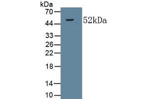 Detection of Recombinant COL5a2, Human using Monoclonal Antibody to Collagen Type V Alpha 2 (COL5a2) (COL5A2 antibody  (AA 82-308))
