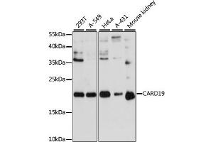 Western blot analysis of extracts of various cell lines, using C antibody (ABIN6127784, ABIN6137941, ABIN6137942 and ABIN6217103) at 1:3000 dilution. (C9orf89 antibody  (AA 1-100))