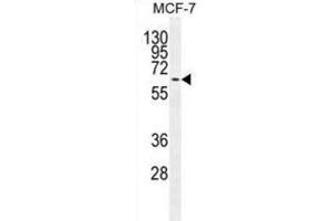 Western Blotting (WB) image for anti-Mitogen-Activated Protein Kinase 15 (MAPK15) antibody (ABIN2995325)