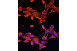 Immunofluorescence analysis of NIH/3T3 cells using AMT Rabbit pAb (ABIN6127345, ABIN6136850, ABIN6136851 and ABIN6225250) at dilution of 1:100. (Aminomethyltransferase antibody  (AA 107-386))