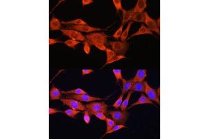 Immunofluorescence analysis of NIH/3T3 cells using AMT Rabbit pAb (ABIN6127345, ABIN6136850, ABIN6136851 and ABIN6225250) at dilution of 1:100. (Aminomethyltransferase antibody  (AA 107-386))