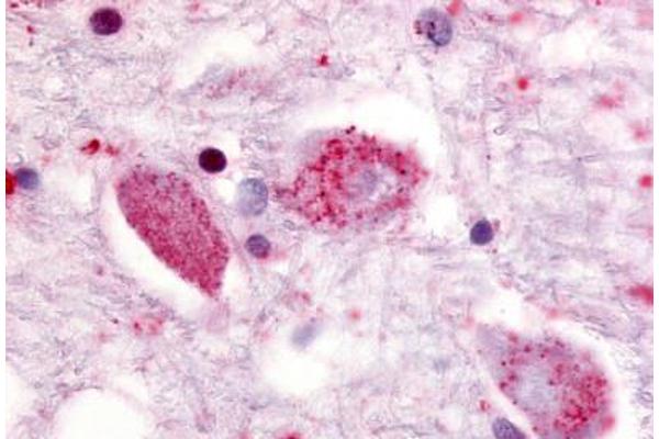 GPR85 antibody  (Cytoplasmic Domain)