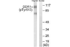 Immunohistochemistry analysis of paraffin-embedded human brain tissue using DDR1 (Phospho-Tyr513) antibody. (DDR1 antibody  (pTyr513))