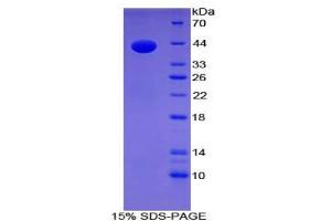 SDS-PAGE analysis of Mouse Gastrin Protein. (Gastrin Protein (GAST))