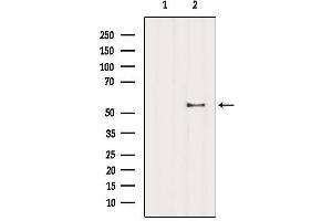 Western blot analysis of extracts from B16F10, using ZNF497 Antibody. (ZNF497 antibody)