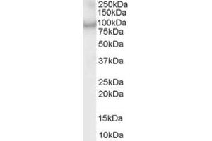 ABIN185097 (1µg/ml) staining of MOLT4 lysate (35µg protein in RIPA buffer). (Centaurin beta 2 antibody  (C-Term))