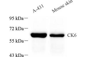 Western blot analysis of CK6 (ABIN7074423) at dilution of 1: 1000 (Keratin 6 antibody)