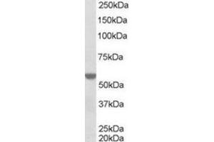 Image no. 1 for anti-Retinoid X Receptor, alpha (RXRA) (Internal Region) antibody (ABIN374477) (Retinoid X Receptor alpha antibody  (Internal Region))