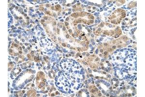 SLC22A3 antibody was used for immunohistochemistry at a concentration of 4-8 ug/ml to stain Epithelial cells of renal tubule (arrows) in Human Kidney. (SLC22A3 antibody)