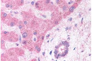 Human Hepatocytes and Bile Duct (formalin-fixed, paraffin-embedded) stained with LRP6 antibody ABIN291653 at 5 ug/ml followed by biotinylated anti-goat IgG secondary antibody ABIN481715, alkaline phosphatase-streptavidin and chromogen. (LRP6 antibody  (AA 1547-1560))