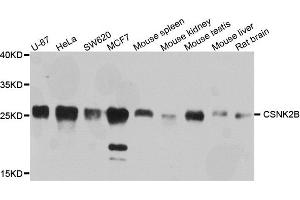 Western blot analysis of extracts of various cells, using CSNK2B antibody.