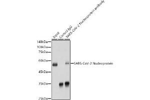 Immunoprecipitation analysis of 300 μg extracts of 293T cells using 3 μg SARS-CoV-2 Nucleoprotein antibody (ABIN7269053). (Nucleoprotein antibody)