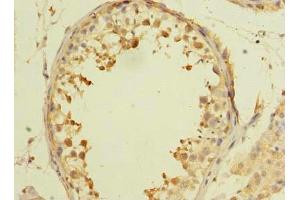 Immunohistochemistry of paraffin-embedded human testis tissue using ABIN7143633 at dilution of 1:100